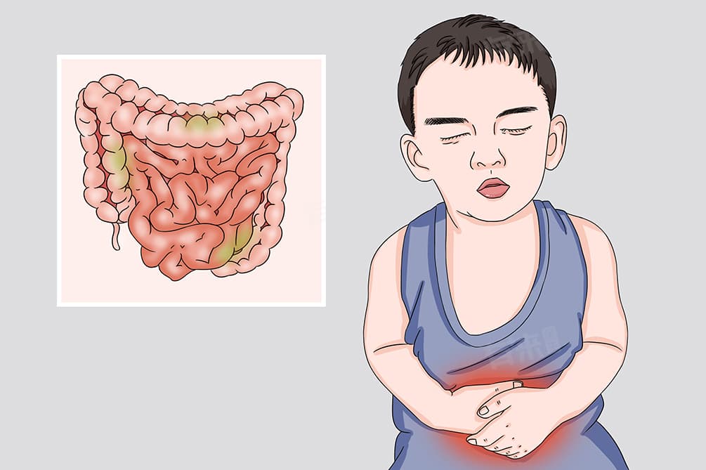 对各类食物中毒的总体预防措施有哪些