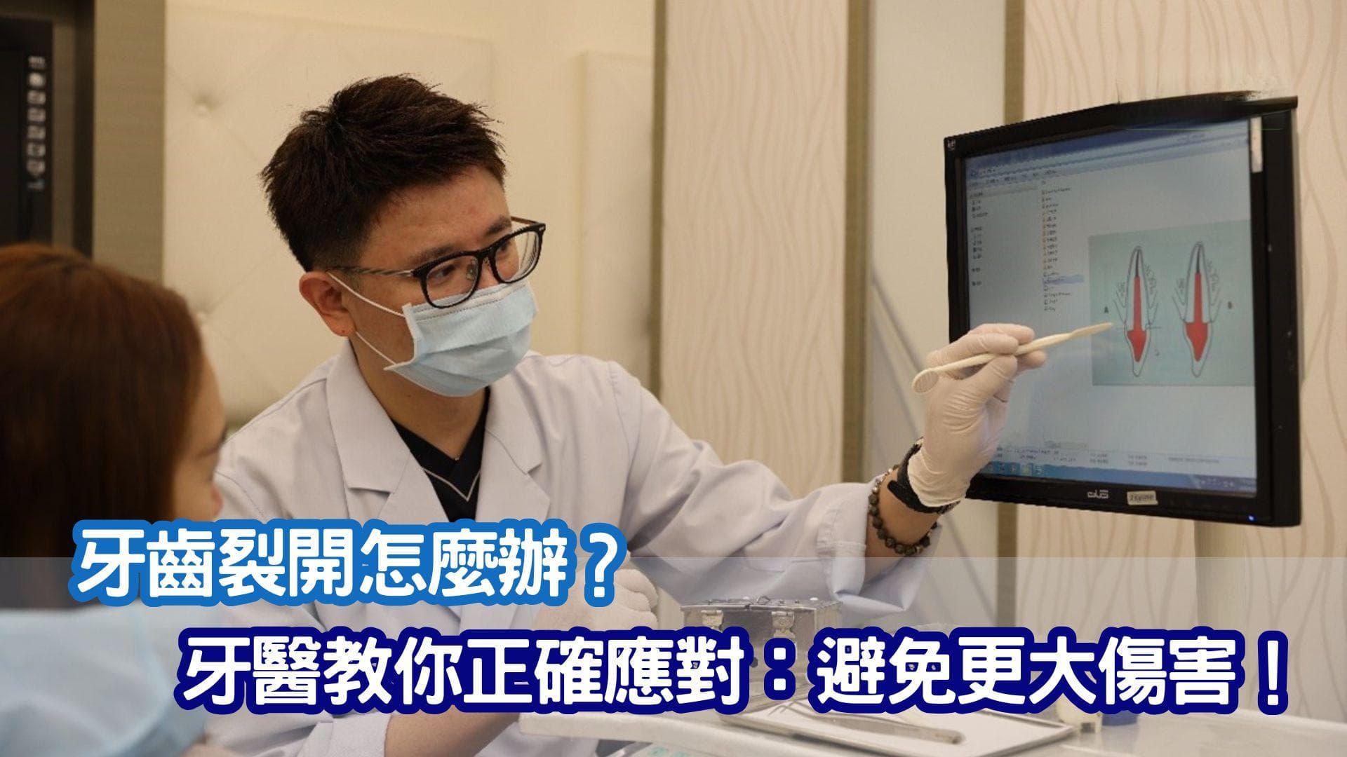 牙齒裂開怎麼辦？牙醫教你正確應對：避免更大傷害！