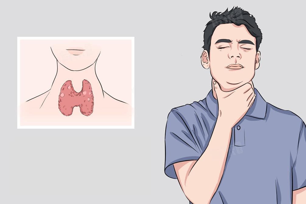 甲状腺结节会引起嗓子哑吗