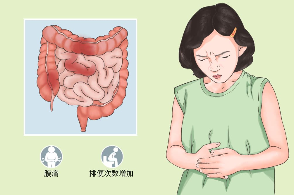 腹泻期间宜吃什么食物