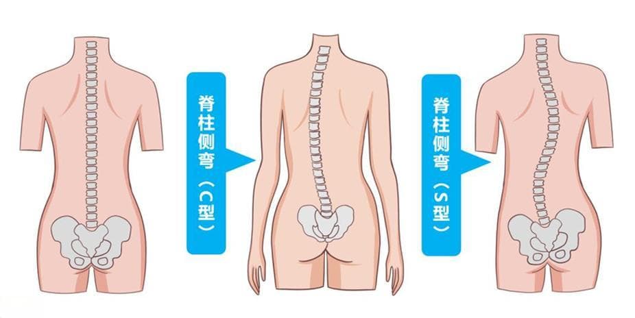关爱少年脊柱，做“正直少年”