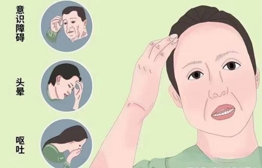什么是脑震荡？症状、诊断与治疗全解析