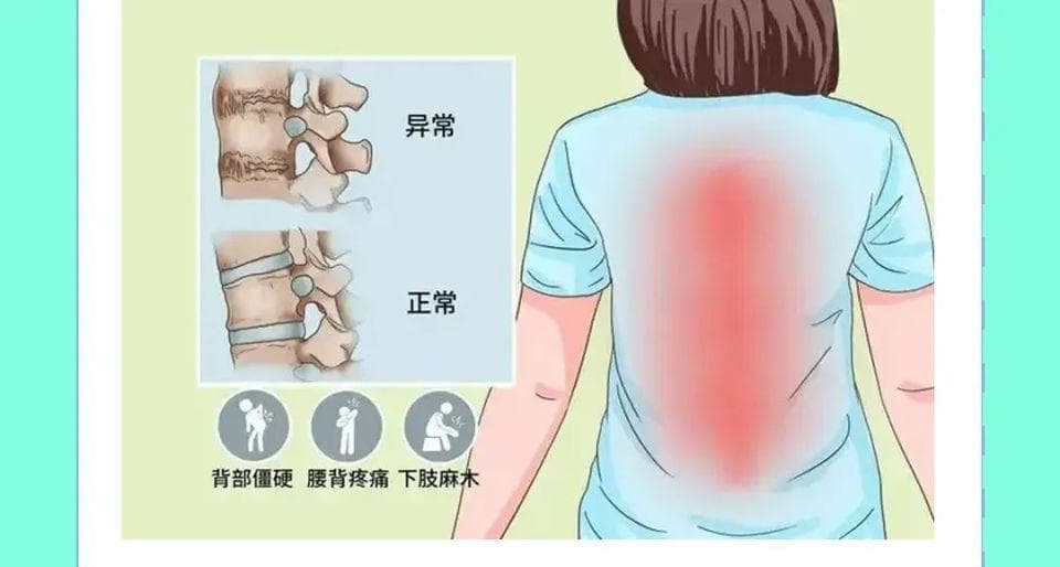 寻求无痛生活：强直性脊柱炎的最新治疗突破