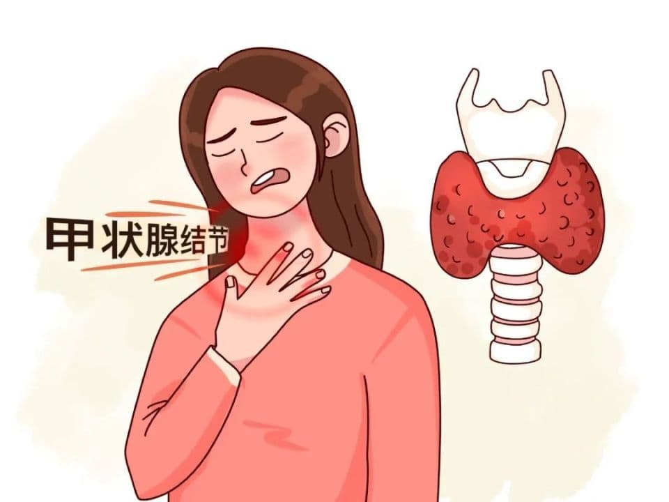 中医治疗甲状腺结节，这5道药膳、2款茶饮，解郁散结