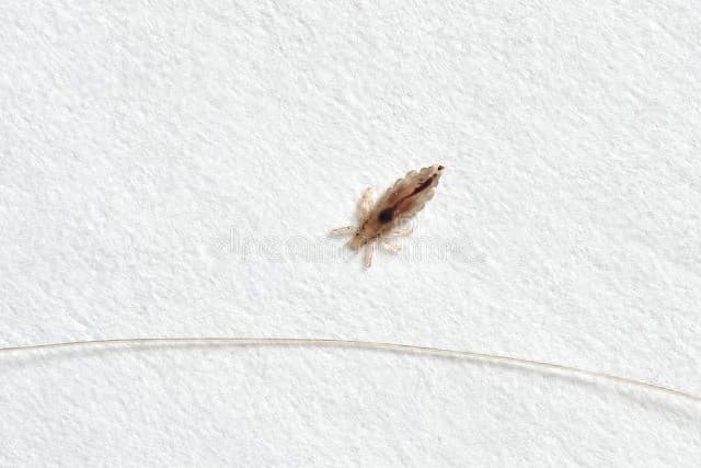 床上为什么有小虫子呢（揭秘床虱的惊人秘密？）