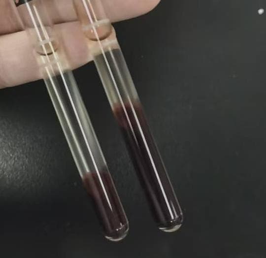 ABO血型系统和Rh系统的简介