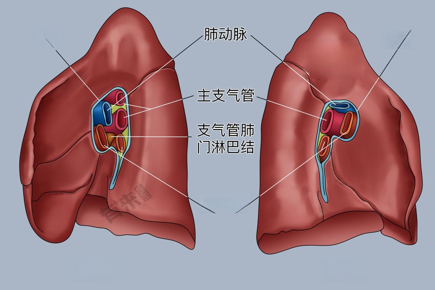 双肺纹理增粗：原因、诊断与治疗全解析