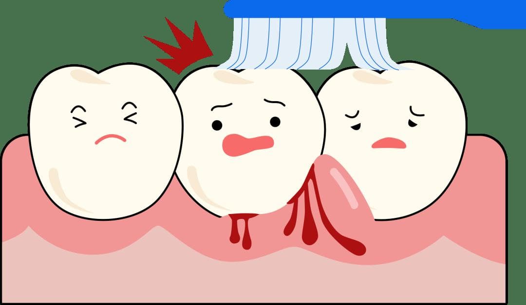 牙龈肿痛出血怎么办？教你7个有效的预防方法！守护口腔健康