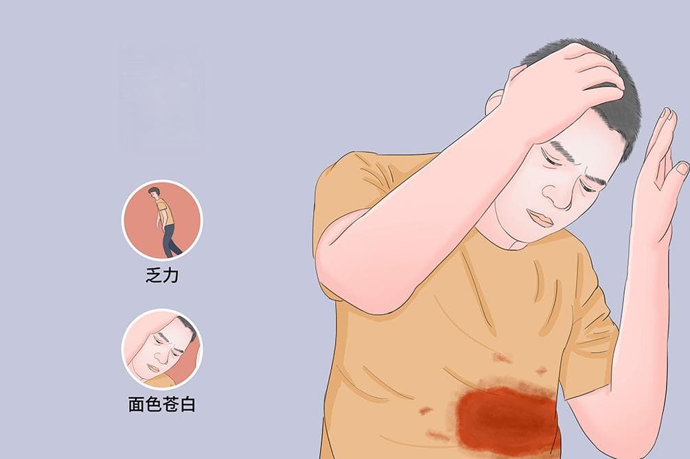 失血过多会有什么症状