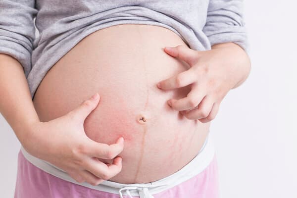 孕妇孕吐吐血丝要紧吗