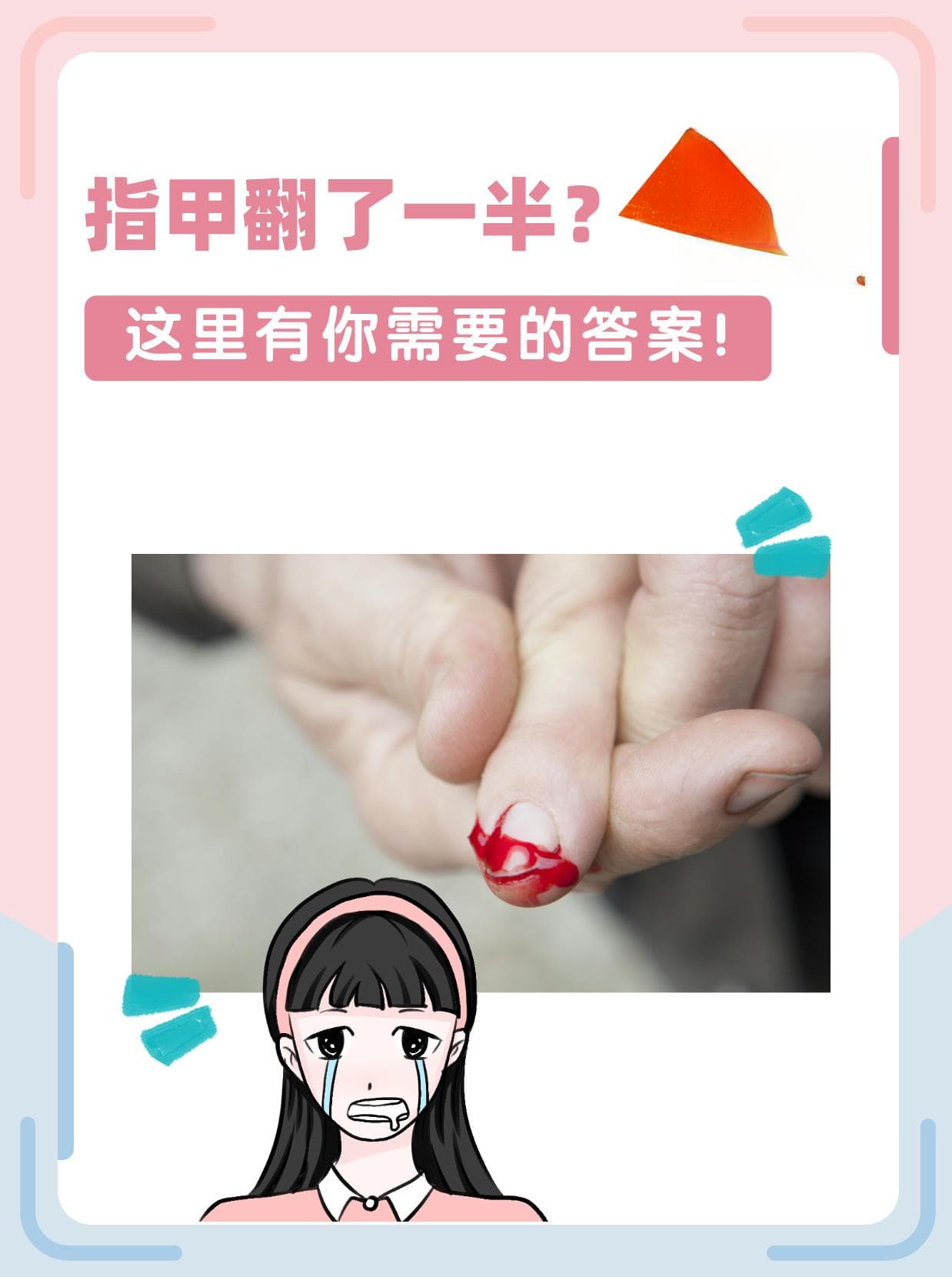 指甲翻了一半？别急，这里有你需要的答案！