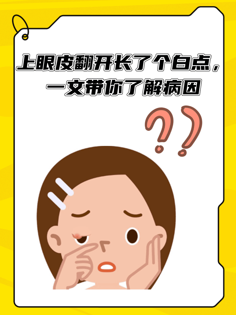 上眼皮白点困扰？快来看看这些可能的原因