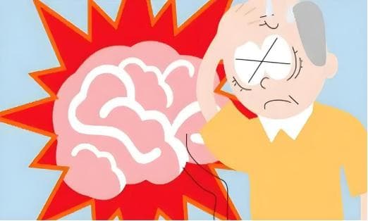 脑卒中偏瘫怎么办？康复治疗与护理要点全解析
