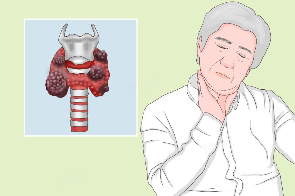 甲状腺癌怎么治疗比较好