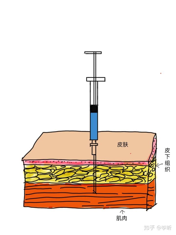 婴儿打疫苗，针都打完几秒后才哭，都这样反应迟钝吗？