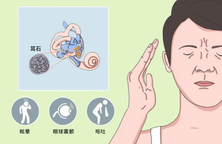 耳石症高发季来了，符合4个特征要警惕
