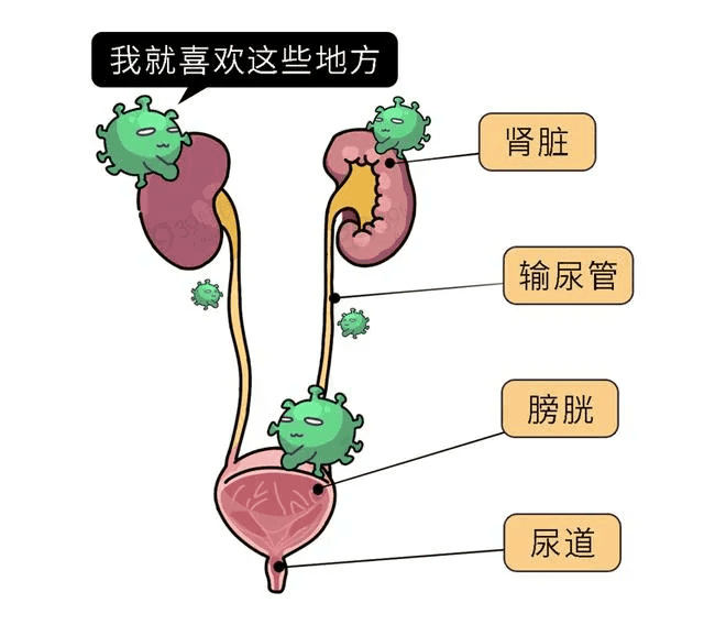 十种用于治疗尿路感染的中成药