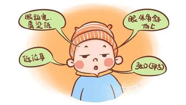 唐氏综合征（21三体综合征）：病因、症状与预防措施