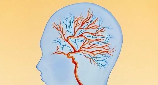脑供血不足与心理健康：关联机制与预防方法