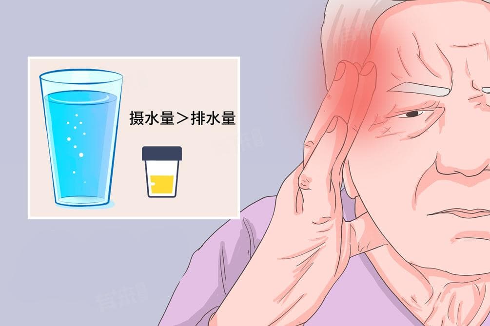 人一天喝多少水会中毒？不同人群的饮水安全指南