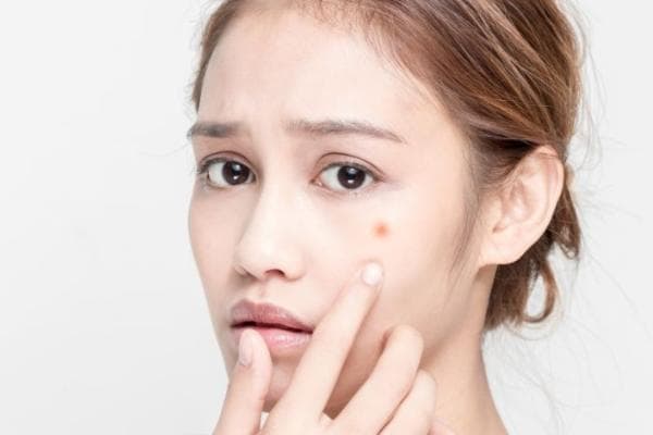 女人湿热重身体有这5大症状 湿热重吃什么可以调理