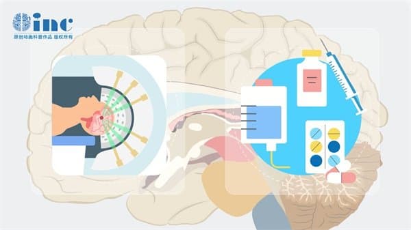 脑胶质瘤手术费用要多少?医保报销吗?