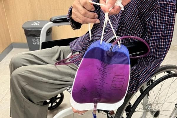 小便7种“色号”透露的健康真相
