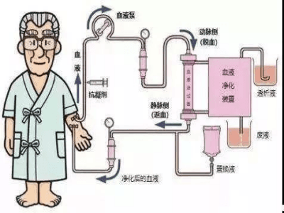 浙里康养科普：血液透析/血液灌流/血液透析滤过