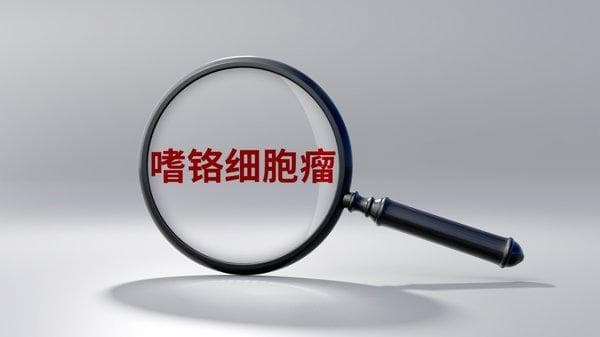 嗜铬细胞瘤体检能查出来吗