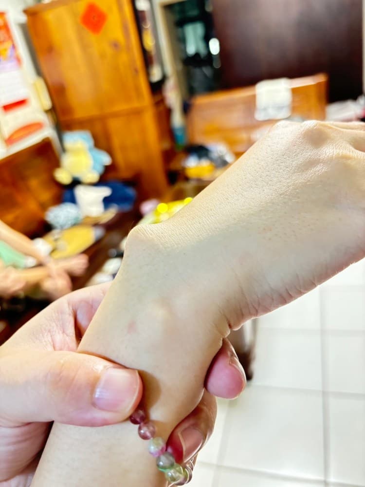 认识腱鞘囊肿及其治疗方法