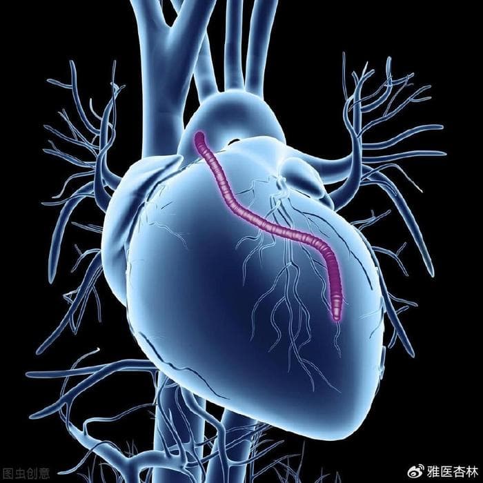 医生科普：心力衰竭的基础药物治疗——利尿药