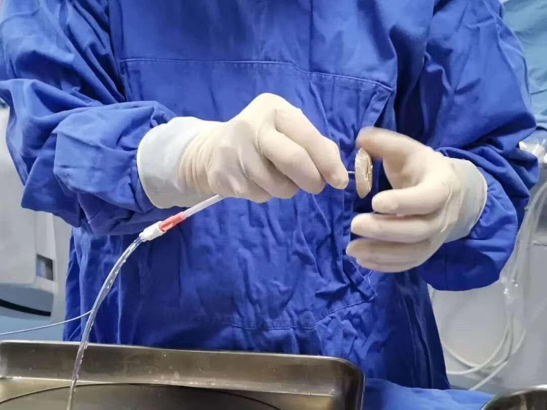 房间隔缺损微创治疗