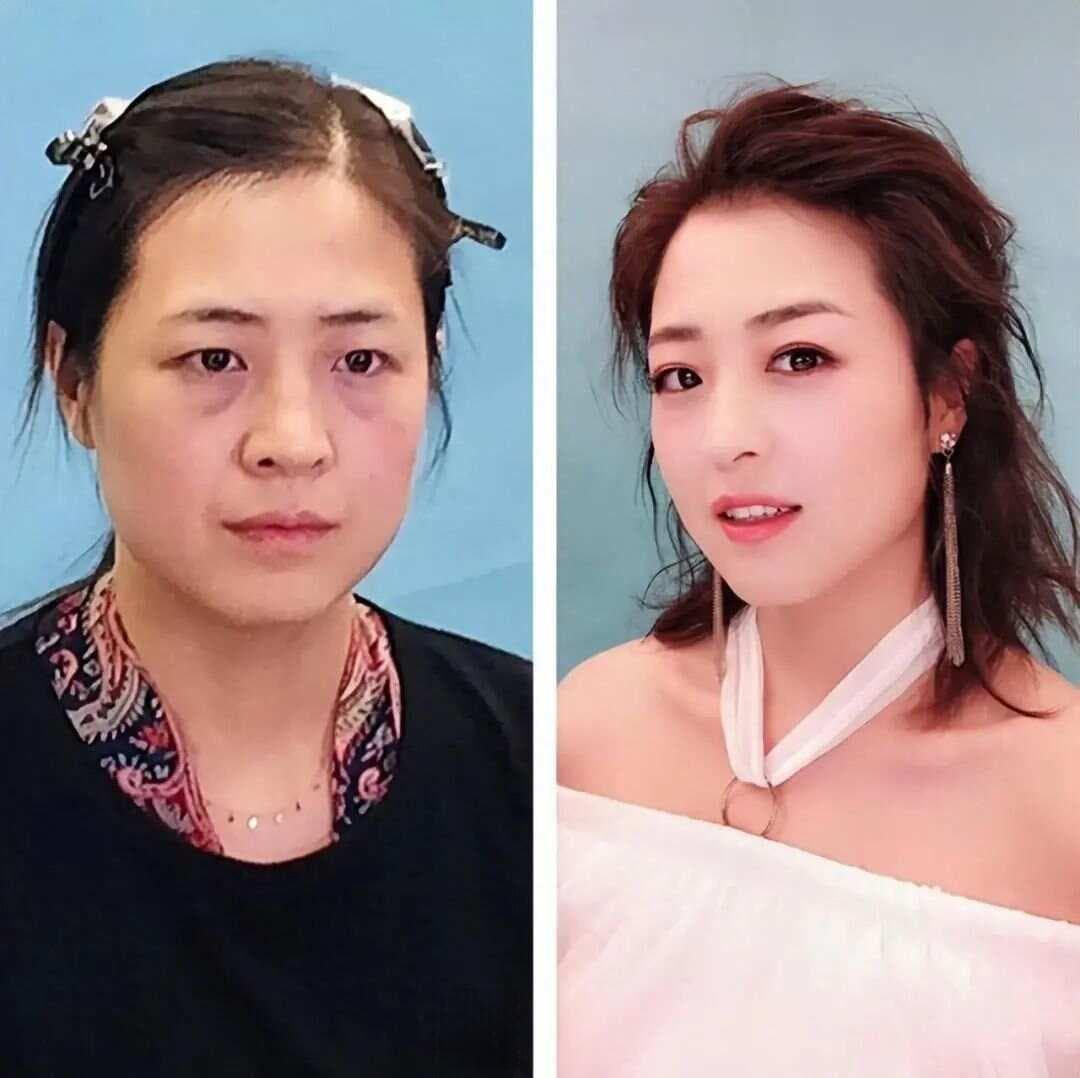 比高颧骨更拉垮的是“凹脸”，刻薄苦相心机感，快看你身边有无！