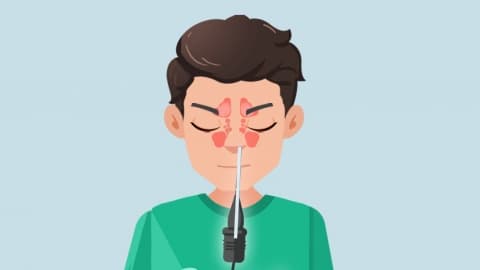鼻翼如何变窄