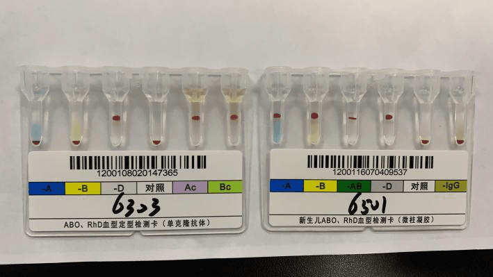 我 B 型血，老婆 O 型血，这个 AB 型血的孩子是谁的？！