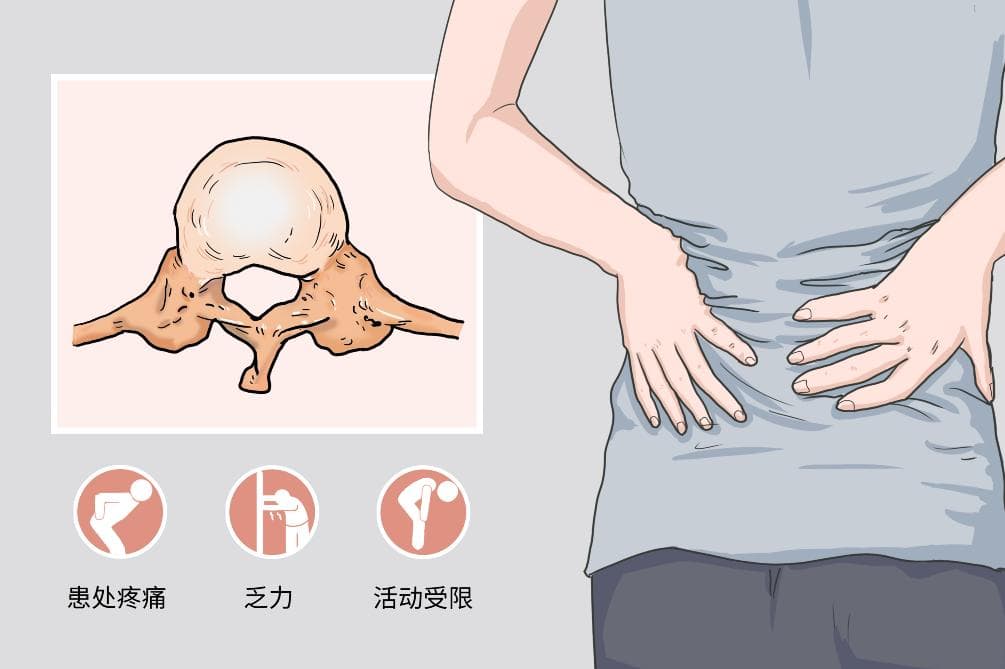消除钙化最简单的方法