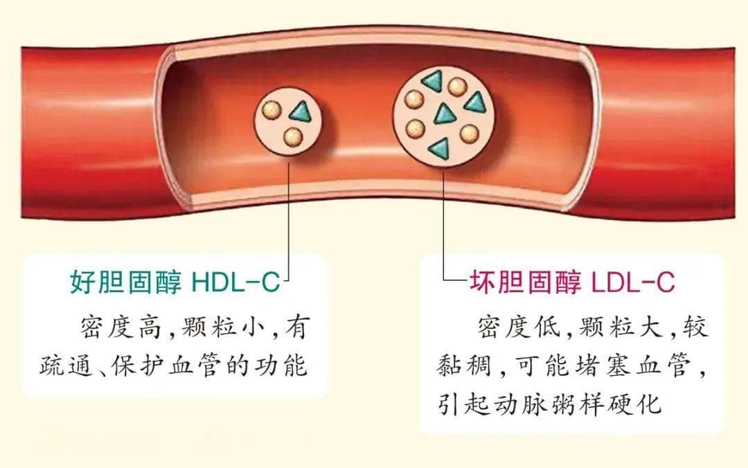 关于胆固醇的高低好坏的最新研究来了