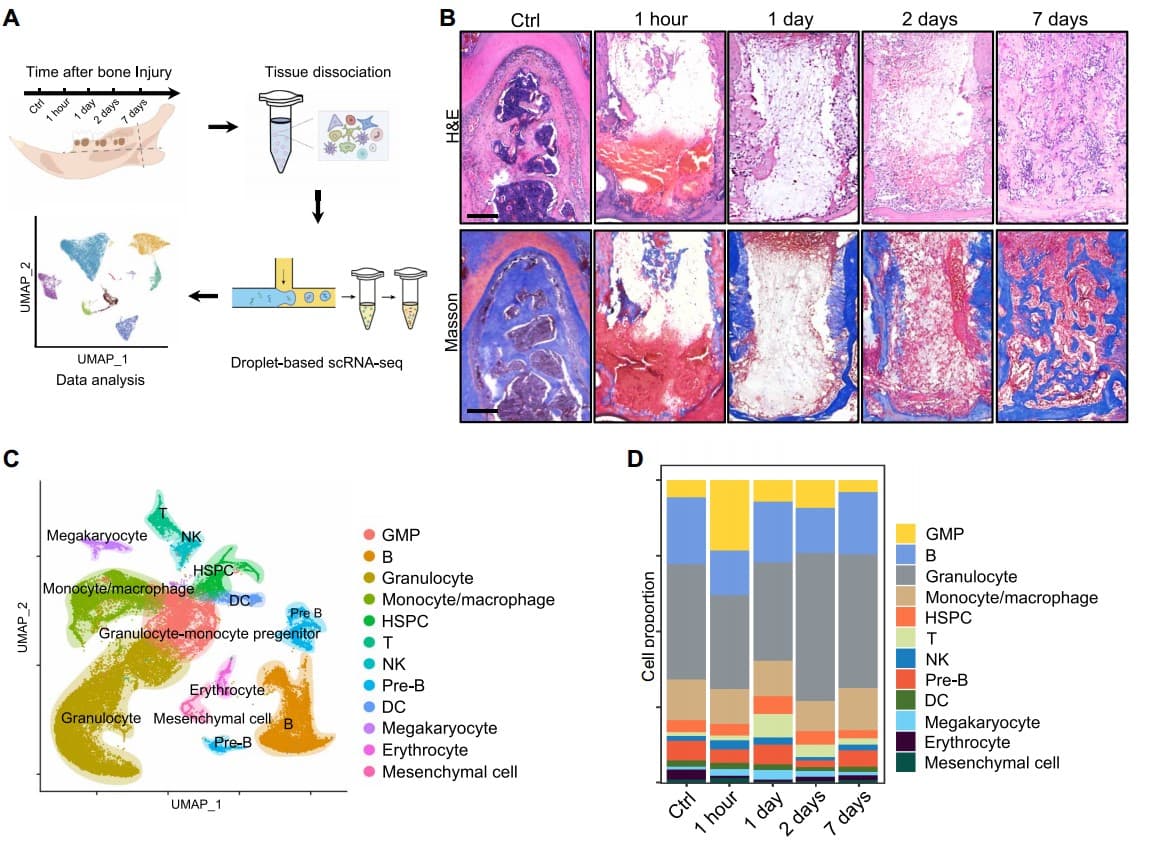 Science Advances：NKT细胞在骨愈合早期发挥重要作用