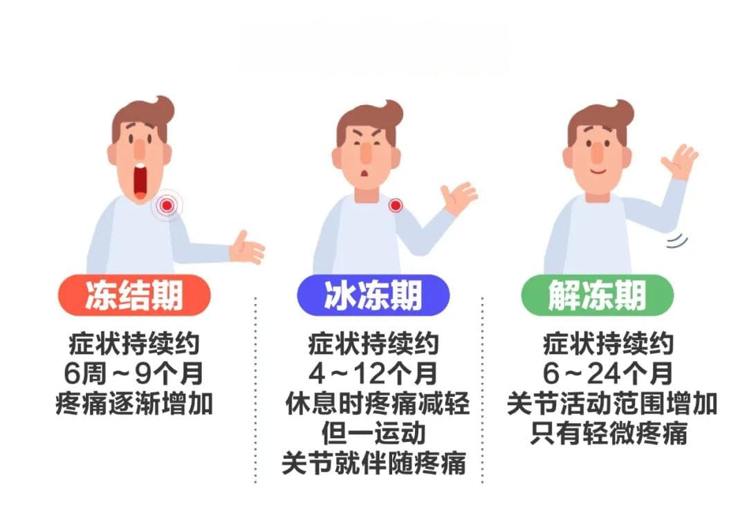 五十肩会自己好吗？