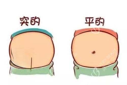 为什么有的人肚脐是竖的？圆肚脐和竖肚脐哪个更好看呢？