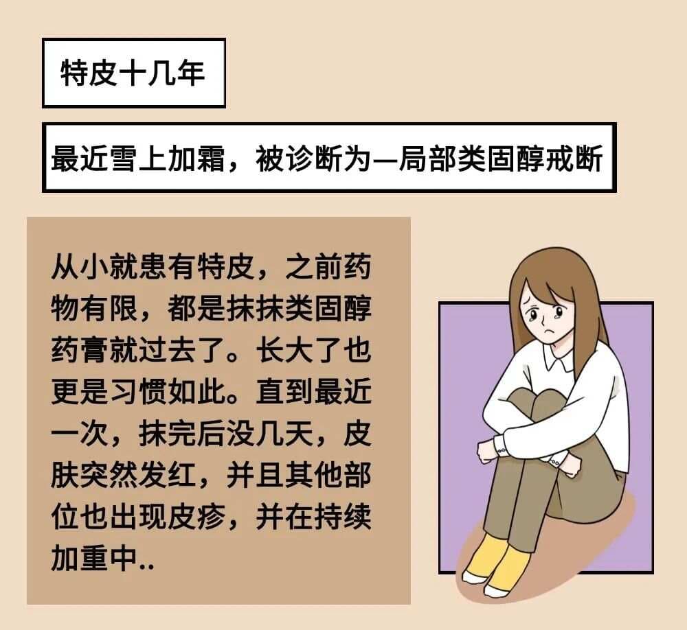 外用激素药的“反弹”危机！特应性皮炎的隐痛该如何解决？