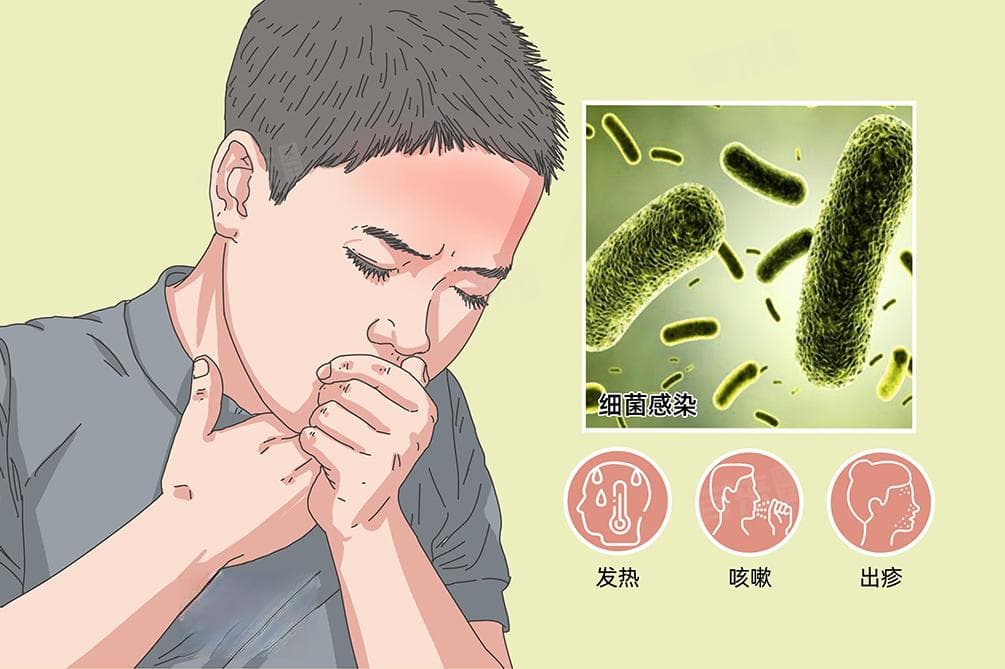 细菌感染发烧反复发烧一般几天能好