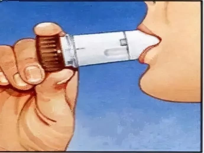 药学科普｜4种常用的吸入性糖皮质激素如何选择，从这3方面考虑