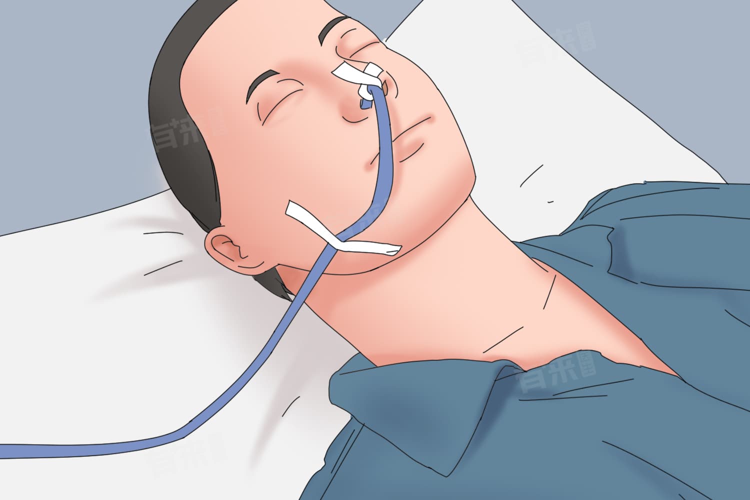 胃管多久更换一次？一文详解胃管更换周期与护理要点