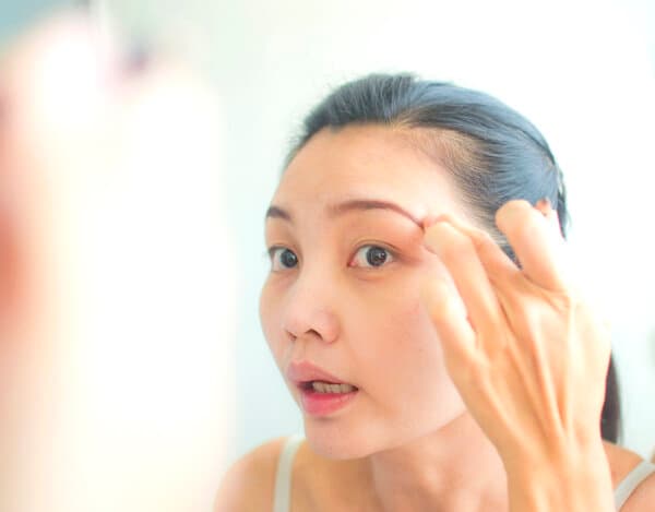 眉毛变白是怎么回事