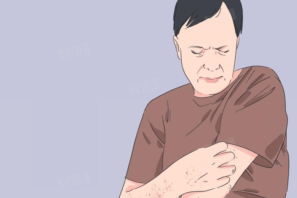 树人症是什么病，能治愈吗