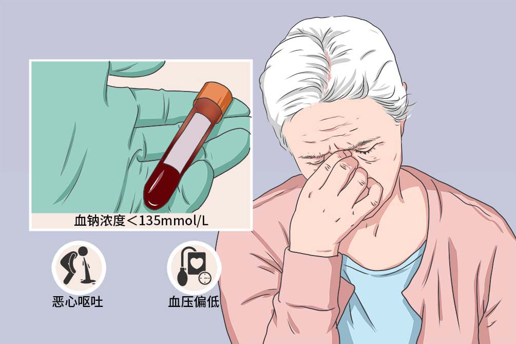 低钠血症：症状、诊断与治疗全解析