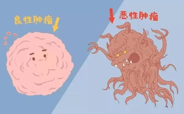 神经外科：头皮长了"肉疙瘩"怎么办？