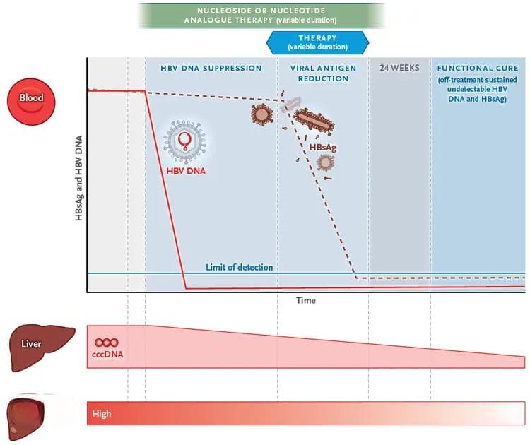 多名患者达乙肝功能性治愈！NEJM：新疗法停药后持续“清除”病毒