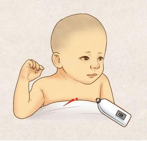 新生儿黄疸怎么检测